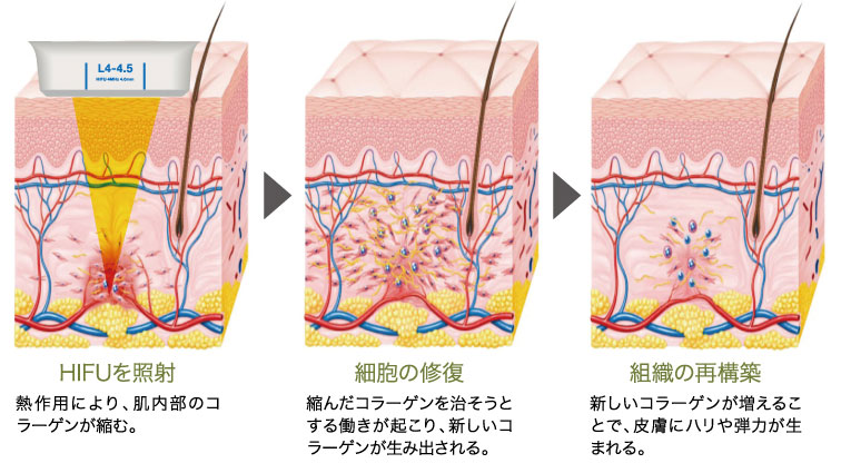 肌内部のプロセス