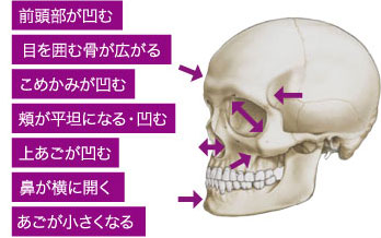 シワ たるみ治療 メディアージュクリニック大阪梅田院 美容皮膚科 エイジマネージメント