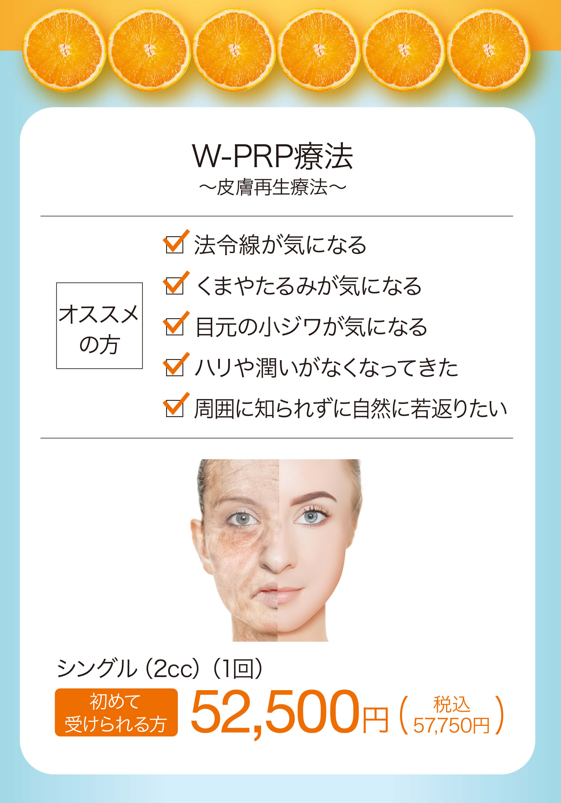 W-PRP療法