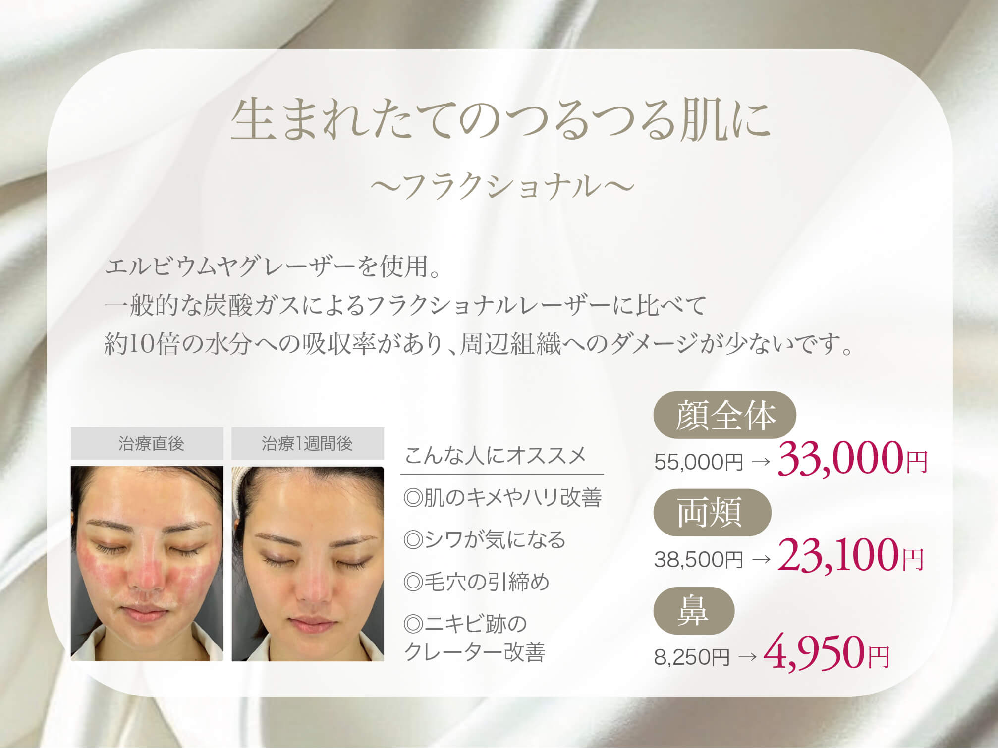 フラクショナル,エルビウムヤグレーザー,