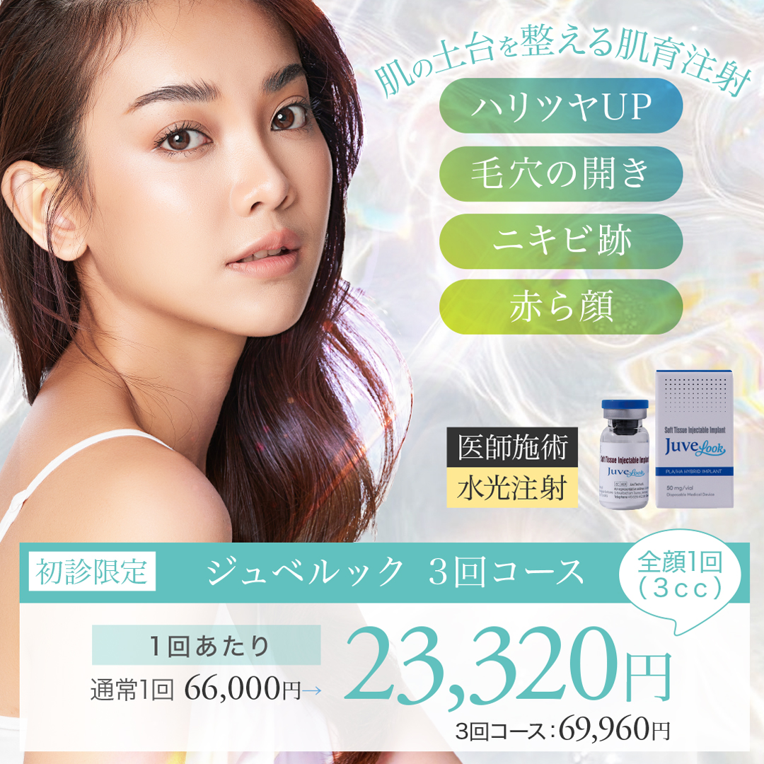 ジュベルック