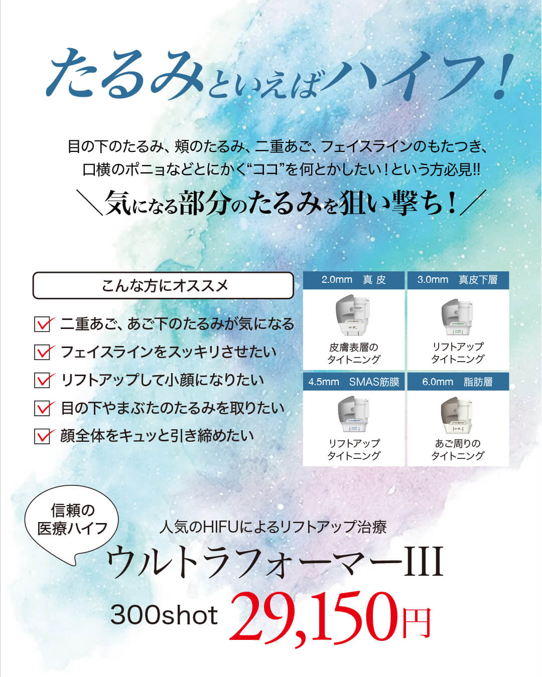 医療ハイフ,ハイフ,ウルトラフォーマーIII,たるみ治療,小顔,リフトアップ
